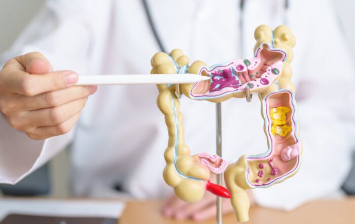 Colitis ulcerosa und Berufsunfähigkeitsversicherung