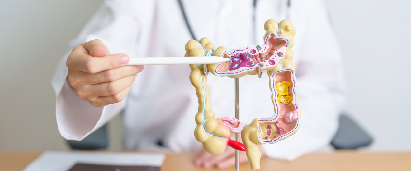 Colitis ulcerosa und Berufsunfähigkeitsversicherung